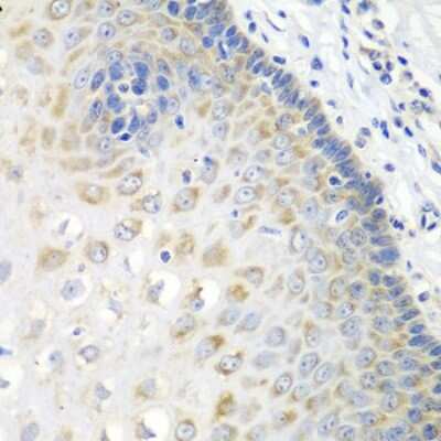 Immunohistochemistry-Paraffin: Syntaxin Binding Protein 4 Antibody [NBP2-94904] - Immunohistochemistry of paraffin-embedded human esophagus using Syntaxin Binding Protein 4 antibody (NBP2-94904) at dilution of 1:100 (40x lens). Perform microwave antigen retrieval with 10 mM PBS buffer pH 7.2 before commencing with IHC staining protocol.