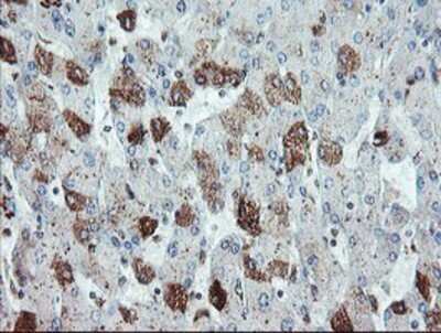 Immunohistochemistry: Syntenin 1 Antibody (OTI2H6) - Azide and BSA Free [NBP2-74418] - Staining of paraffin-embedded Human liver tissue using anti-Syntenin 1 mouse monoclonal antibody.