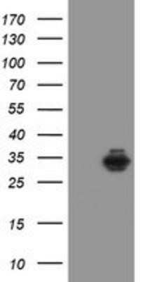 Western Blot: Syntenin 1 Antibody (OTI2H6) - Azide and BSA Free [NBP2-74418] - HEK293T cells were transfected with the pCMV6-ENTRY control (Left lane) or pCMV6-ENTRY Syntenin 1 (Right lane) cDNA for 48 hrs and lysed. Equivalent amounts of cell lysates (5 ug per lane) were separated by SDS-PAGE and immunoblotted with anti-Syntenin 1.