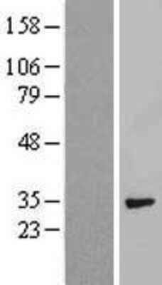 Western Blot Syntenin 1 Overexpression Lysate