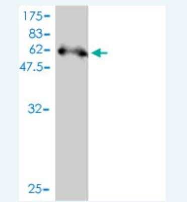 Western Blot: Syntenin 2 Antibody (3E8) [H00027111-M01] - Detection against Immunogen (57.86 KDa) .