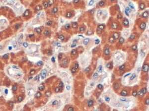 Immunohistochemistry-Paraffin Syntenin 2 Antibody