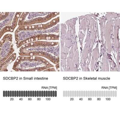 <b>Orthogonal Strategies Validation. </b>Immunohistochemistry-Paraffin: Syntenin 2 Antibody [NBP2-62642] - Immunohistochemistry analysis in human small intestine and skeletal muscle tissues using Anti-SDCBP2 antibody. Corresponding SDCBP2 RNA-seq data are presented for the same tissues.