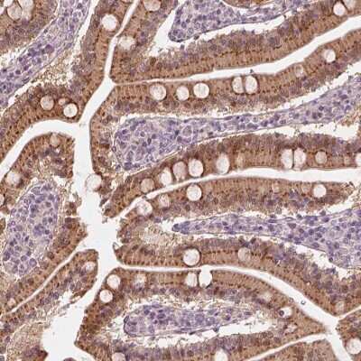 Immunohistochemistry-Paraffin Syntenin 2 Antibody - BSA Free