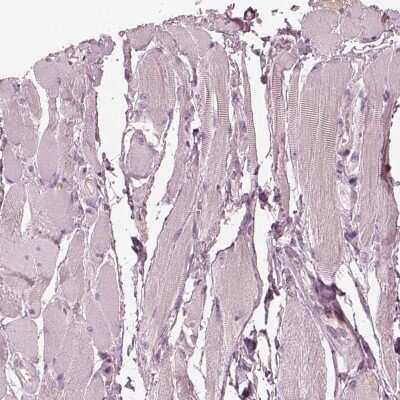 Immunohistochemistry-Paraffin: Syntenin 2 Antibody [NBP2-62642] - Staining of human skeletal muscle shows low expression as expected.