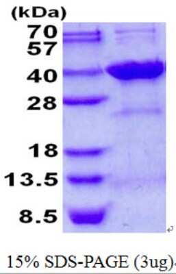 SDS-PAGE Recombinant Human Syntenin 2 His Protein