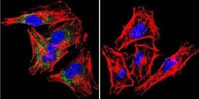 Immunocytochemistry/Immunofluorescence: Syntrophin Antibody (1351) [NB600-1294] - Analysis of Syntrophin using Syntrophin Monoclonal Antibody (1351) shows staining in A2058 Cells. Syntrophin (green), F-Actin staining with Phalloidin (red) and nuclei with DAPI (blue) is shown. Cells were grown on chamber slides and fixed with formaldehyde prior to staining. Cells were probed without (control) or with an antibody recognizing Syntrophin at a dilution of 1:20 over night at 4C, washed with PBS and incubated with a DyLight-488 conjugated.
