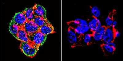 Immunocytochemistry/Immunofluorescence: Syntrophin Antibody (1351) [NB600-1294] - Analysis of Syntrophin using Syntrophin Monoclonal Antibody (1351) shows staining in 293Cells. Syntrophin (green), F-Actin staining with Phalloidin (red) and nuclei with DAPI (blue) is shown. Cells were grown on chamber slides and fixed with formaldehyde prior to staining. Cells were probed without (control) or with an antibody recognizing Syntrophin at a dilution of 1:20 over night at 4C, washed with PBS and incubated with a DyLight-488 conjugated.