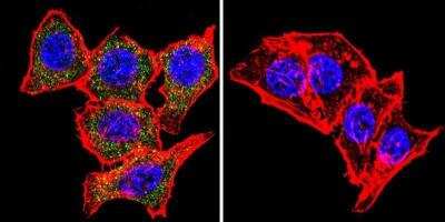 Immunocytochemistry/Immunofluorescence: Syntrophin Antibody (1351) [NB600-1294] - Analysis of Syntrophin using Syntrophin Monoclonal Antibody (1351) shows staining in Hela Cells. Syntrophin (green), F-Actin staining with Phalloidin (red) and nuclei with DAPI (blue) is shown. Cells were grown on chamber slides and fixed with formaldehyde prior to staining. Cells were probed without (control) or with an antibody recognizing Syntrophin at a dilution of 1:20 over night at 4C, washed with PBS and incubated with a DyLight-488 conjugated.