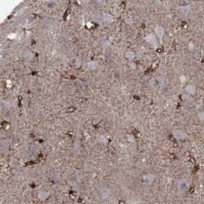 Immunohistochemistry-Paraffin: Syntrophin Antibody [NBP3-17941] - Staining of human cerebral cortex shows strong cytoplasmic positivity in glial cells and endothelial cells.