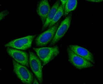 Immunocytochemistry/Immunofluorescence: Syntrophin Antibody (JG35-62) [NBP2-76874] - ICC staining Syntrophin alpha 1 in SiHa cells (green). The nuclear counter stain is DAPI (blue). Cells were fixed in paraformaldehyde, permeabilised with 0.25% Triton X100/PBS.