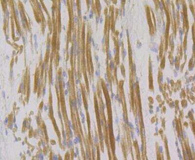 Immunohistochemistry: Syntrophin Antibody (JG35-62) [NBP2-76874] - Immunohistochemical analysis of paraffin-embedded human skeletal muscle tissue using anti-Syntrophin alpha 1 antibody. Counter stained with hematoxylin.