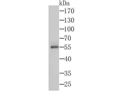 Western Blot: Syntrophin Antibody (JG35-62) [NBP2-76874] - Western blot analysis of Syntrophin alpha 1 on SiHa cells lysates using anti-Syntrophin alpha 1 antibody at 1/1,000 dilution.