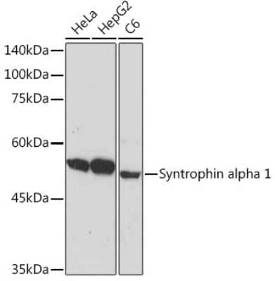 Western Blot: Syntrophin alpha 1 Antibody (3B10G10) [NBP3-15899] - Western blot analysis of extracts of various cell lines, using Syntrophin alpha 1 Rabbit mAb (NBP3-15899) at 1:1000 dilution. Secondary antibody: HRP Goat Anti-Rabbit IgG (H+L) at 1:10000 dilution. Lysates/proteins: 25ug per lane. Blocking buffer: 3% nonfat dry milk in TBST. Detection: ECL Basic Kit. Exposure time: 10s.