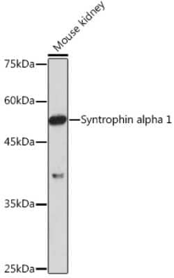 Western Blot: Syntrophin alpha 1 Antibody (3B10G10) [NBP3-15899] - Western blot analysis of extracts of Mouse kidney, using Syntrophin alpha 1 Rabbit mAb (NBP3-15899) at 1:1000 dilution. Secondary antibody: HRP Goat Anti-Rabbit IgG (H+L) at 1:10000 dilution. Lysates/proteins: 25ug per lane. Blocking buffer: 3% nonfat dry milk in TBST. Detection: ECL Enhanced Kit. Exposure time: 180s.