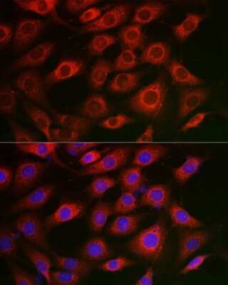 Immunocytochemistry/Immunofluorescence: Syntrophin alpha 1 Antibody [NBP3-16017] - Immunofluorescence analysis of NIH/3T3 cells using Syntrophin alpha 1 Rabbit pAb (NBP3-16017) at dilution of 1:50 (40x lens). Blue: DAPI for nuclear staining.