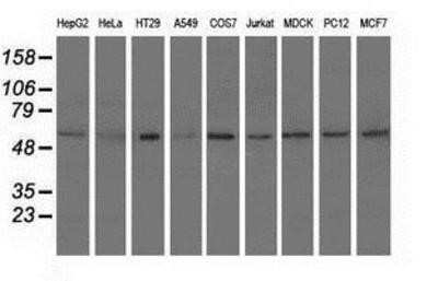 Western Blot: Syntrophin alpha 1 Antibody (OTI1H10) - Azide and BSA Free [NBP2-74422] - Analysis of extracts (35ug) from 9 different cell lines by using anti-Syntrophin alpha 1 monoclonal antibody.