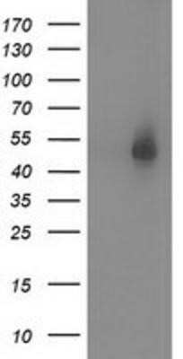 Western Blot: Syntrophin alpha 1 Antibody (OTI1H10) - Azide and BSA Free [NBP2-74422] - HEK293T cells were transfected with the pCMV6-ENTRY control (Left lane) or pCMV6-ENTRY Syntrophin alpha 1 (Right lane) cDNA for 48 hrs and lysed. Equivalent amounts of cell lysates (5 ug per lane) were separated by SDS-PAGE and immunoblotted with anti-Syn