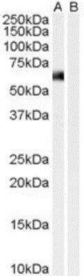Western Blot: Syntrophin alpha 1 Antibody [NB100-1346] - (0.01ug/ml) staining of Human Muscle lysate (35ug protein in RIPA buffer) with (B) and without (A) blocking with the immunising peptide. Primary incubation was 1 hour. Detected by chemiluminescence.