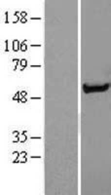 Western Blot Syntrophin alpha 1 Overexpression Lysate