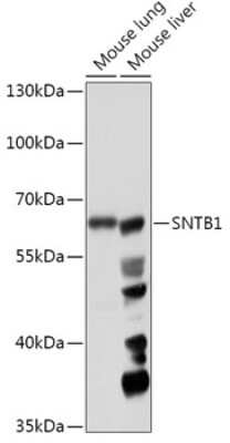 Western Blot: Syntrophin beta 1 Antibody [NBP2-94179] - Analysis of extracts of various cell lines, using Syntrophin beta 1 at 1:1000 dilution. Secondary antibody: HRP Goat Anti-Rabbit IgG (H+L) at 1:10000 dilution. Lysates/proteins: 25ug per lane. Blocking buffer: 3% nonfat dry milk in TBST. Detection: ECL Basic Kit . Exposure time: 30s.