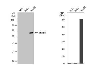 Western Blot: Syntrophin beta 1 Antibody [NBP3-13150] - Various whole cell extracts (30 ug) were separated by 10% SDS-PAGE, and the membrane was blotted with Syntrophin beta 1 antibody (NBP3-13150) diluted at 1:1000. The HRP-conjugated anti-rabbit IgG antibody (NBP2-19301) was used to detect the primary antibody. Corresponding RNA expression data for the same cell lines are based on Human Protein Atlas program.