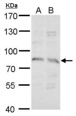 Western Blot: Syntrophin gamma 2 Antibody [NBP2-43799] - Analysis of A. 30 ug A549 whole cell lysate/extract B. 30 ug H1299 whole cell lysate/extract 7.5 % SDS-PAGE Syntrophin gamma 2 antibody dilution: 1:1000.