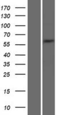 Western Blot Syntrophin gamma 2 Overexpression Lysate