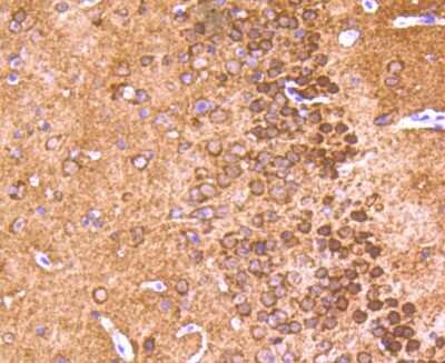 Immunohistochemistry-Paraffin: Synuclein alpha/beta Antibody (ST05-21) [NBP2-67537] - Analysis of paraffin-embedded mouse brain tissue using anti-alpha+beta Synuclein antibody. Counter stained with hematoxylin.