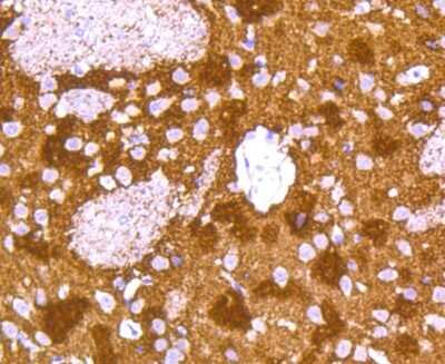 Immunohistochemistry-Paraffin: Synuclein alpha/beta Antibody (ST05-21) [NBP2-67537] - Analysis of paraffin-embedded rat brain tissue using anti-alpha+beta Synuclein antibody. Counter stained with hematoxylin.
