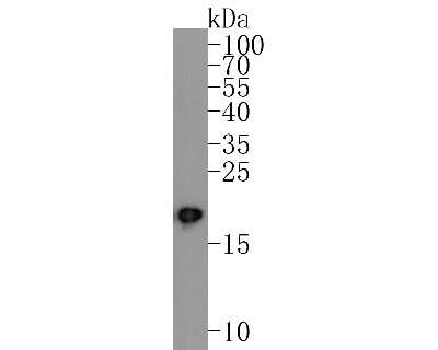 Western Blot: Synuclein alpha/beta Antibody (ST05-21) [NBP2-67537] - Western blot analysis of Synuclein alpha/beta on rat brain tissue lysates. Proteins were transferred to a PVDF membrane and blocked with 5% BSA in PBS for 1 hour at room temperature. The primary antibody (1/500) was used in 5% BSA at room temperature for