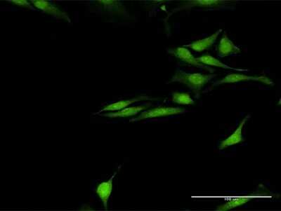 Immunocytochemistry/Immunofluorescence: Synuclein-gamma Antibody [H00006623-D01P] - Analysis of antibody to SNCG on HeLa cell. Antibody concentration 20 ug/ml.
