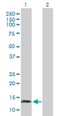 Western Blot: Synuclein-gamma Antibody [H00006623-D01P] - Analysis of SNCG expression in transfected 293T cell line by SNCG polyclonal antibody.Lane 1: SNCG transfected lysate(13.30 KDa).Lane 2: Non-transfected lysate.