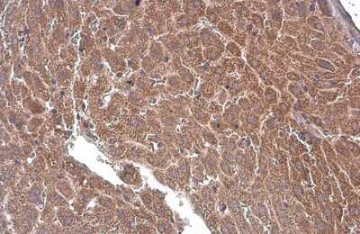 <b>Genetic Strategies Validation. </b>Immunohistochemistry-Paraffin: T Plastin Antibody (GT236) [NBP3-13517] - T Plastin antibody [GT236] detects T Plastin protein at cytoplasm by immunohistochemical analysis. Sample: Paraffin-embedded mouse liver. T Plastin stained by T Plastin antibody [GT236] (NBP3-13517) diluted at 1:200. Antigen Retrieval: Citrate buffer, pH 6.0, 15 min