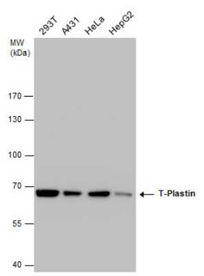 Western Blot: T Plastin Antibody (GT236) [NBP3-13517] - T Plastin antibody detects T Plastin protein by western blot analysis. Various whole cell extracts (30 ug) were separated by 7.5% SDS-PAGE, and the membrane was blotted with T Plastin antibody (NBP3-13517) diluted at a dilution of 1:1000.