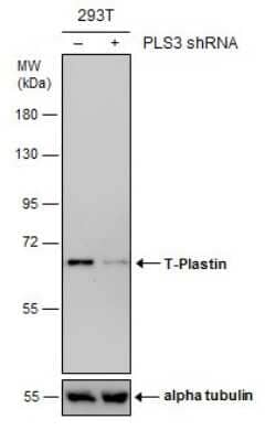 Western Blot: T Plastin Antibody (GT236) [NBP3-13517] - Non-transfected (-) and transfected (+) 293T whole cell extracts (30 ug) were separated by 7.5% SDS-PAGE, and the membrane was blotted with T Plastin antibody [GT236] (NBP3-13517) diluted at 1:1000.