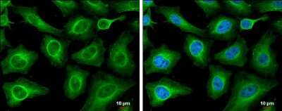 Immunocytochemistry/ Immunofluorescence T Plastin Antibody (GT3310) - Azide and BSA Free