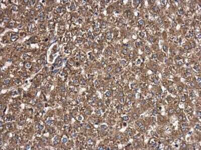 Immunohistochemistry-Paraffin T Plastin Antibody (GT3310) - Azide and BSA Free