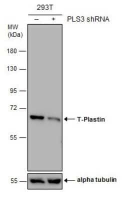 Western Blot T Plastin Antibody (GT3310) - Azide and BSA Free