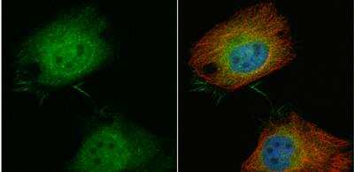 Immunocytochemistry/Immunofluorescence: T Plastin Antibody [NBP1-32380] - HeLa cells were fixed in 4% paraformaldehyde at RT for 15 min. Green: T-Plastin protein stained by T-Plastin antibody  diluted at 1:100. Red: alpha Tubulin, a cytoskeleton marker, stained by alpha Tubulin antibody [114] diluted at 1:500.Blue: Hoechst 33342 staining.