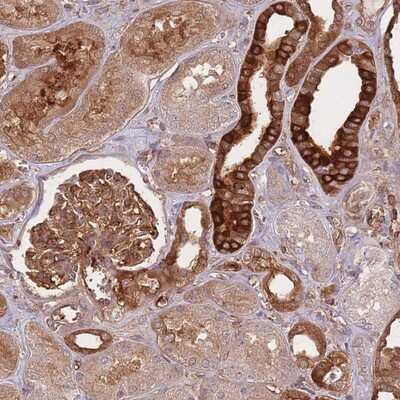 Immunohistochemistry-Paraffin: T Plastin Antibody [NBP2-13778] - Staining of human kidney shows strong cytoplasmic positivity in cells in tubules.