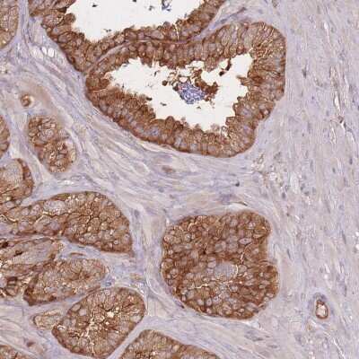 Immunohistochemistry-Paraffin: T Plastin Antibody [NBP2-13778] - Staining of human seminal vesicle shows high expression.