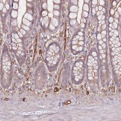Immunohistochemistry-Paraffin: T Plastin Antibody [NBP2-13778] - Staining of human small intestine shows low expression as expected.