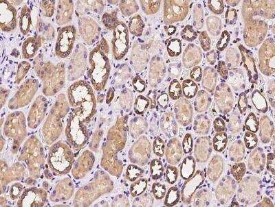 Immunohistochemistry-Paraffin: T Plastin Antibody [NBP3-06608] - Staining of human PLS3 in human kidney with rabbit polyclonal antibody at 1:300 dilution.