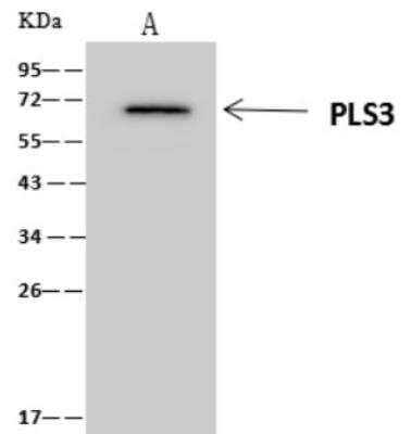Immunoprecipitation: T Plastin Antibody [NBP3-06608] - Lane A:0.5 mg K562 Whole Cell Lysate 4 uL anti-PLS3 rabbit polyclonal antibody and 60 ug of Immunomagnetic beads Protein A/G. Primary antibody: Anti-PLS3 rabbit polyclonal antibody,at 1:100 dilution Secondary antibody: Clean-Blot IP Detection Reagent (HRP) at 1:1000 dilution Developed using the ECL technique. Performed under reducing conditions. Predicted band size: 60 kDa Observed band size :60 kDa