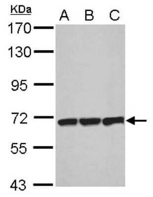 Western Blot T Plastin Antibody