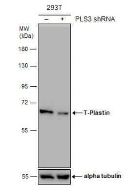 Western Blot T Plastin Antibody