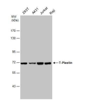 Western Blot: T Plastin Antibody [NBP1-32380] - Various whole cell extracts (30 ug) were separated by 7.5% SDS-PAGE, and the membrane was blotted with T-Plastin antibody diluted at a dilution of 1:1000. The HRP-conjugated anti-rabbit IgG antibody (NBP2-19301) was used to detect the primary antibody.