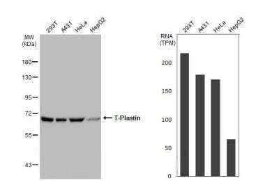 Western Blot T Plastin Antibody