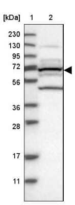Western Blot: T Plastin Antibody [NBP2-13778] - Lane 1: Marker  [kDa] 230, 130, 95, 72, 56, 36, 28, 17, 11.  Lane 2: Human cell line RT-565